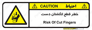 hand , body , risk , cutting down , قطع عضو , 