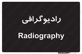  , اشعه , سی تی اسکن , ایکس ری , 