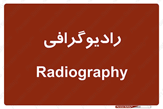  , اشعه , سی تی اسکن , ایکس ری , 