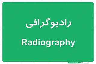 , اشعه , سی تی اسکن , ایکس ری , 