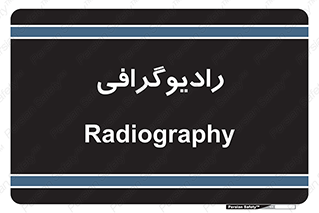  , اشعه , سی تی اسکن , ایکس ری , 