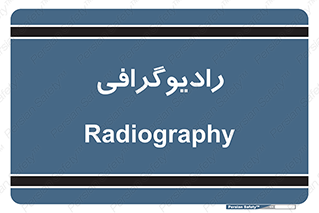  , اشعه , سی تی اسکن , ایکس ری , 