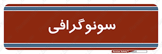  , عکس برداری , 