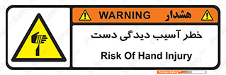  , حادثه , انگشت , 