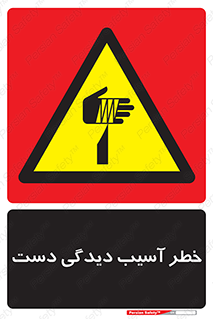  , حادثه , انگشت , 