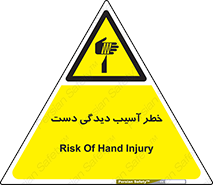  , حادثه , انگشت , 