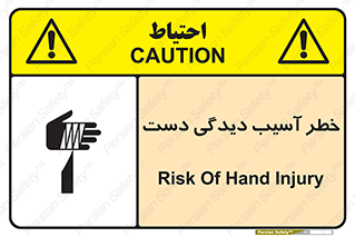  , حادثه , انگشت , 